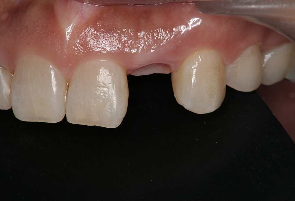 ⑥スペース確保拡大